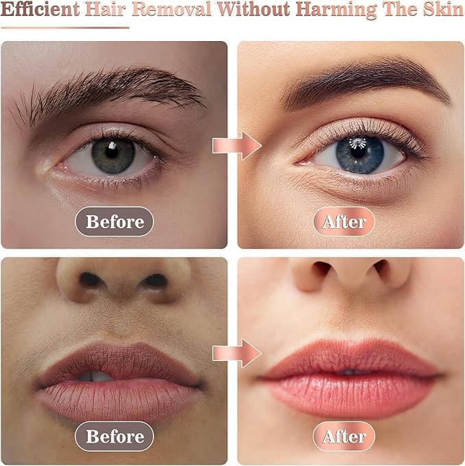Facial Hair Remover For Women, (White & Golden)